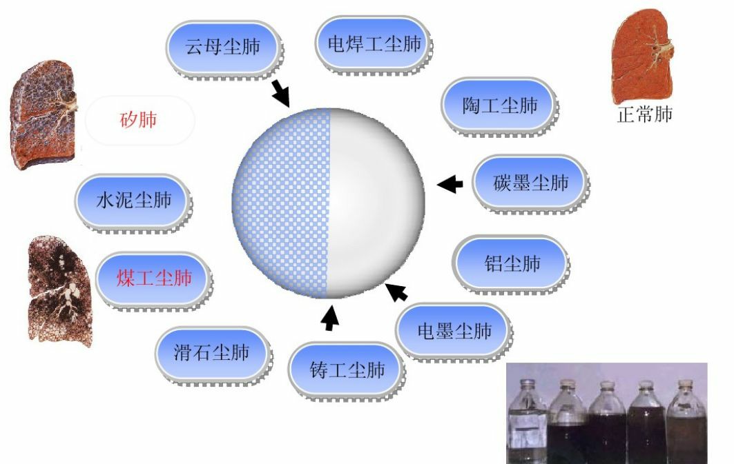 海固安防|预防吸入粉尘，保护个人健康！